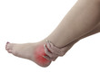 Pain in a woman ankle