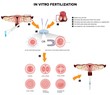 In vitro fertilization. Detailed illustrations