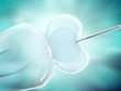 In vitro fertilization