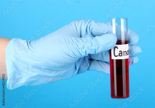 Photo: Test tube labeled Cancer in hand on blue background Test tube labeled Cancer in hand on blue background
