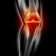 Knie-Schmerzen - Röntgenbild - 3D Grafik