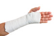 Photo: Broken arm with a plaster cast isolated on white Broken arm with a plaster cast isolated on white