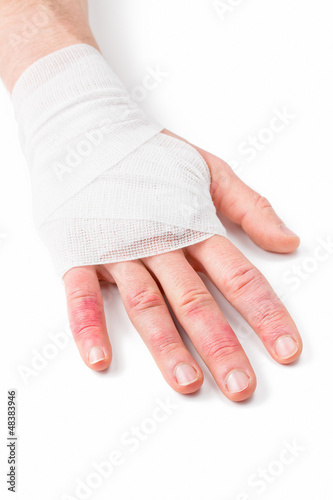 Photo: Verletzte Hand Verletzte Hand