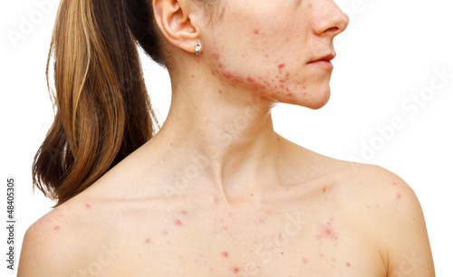 Photo: Skin problems Skin problems