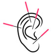 Illustration of ear acupuncture