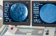 Angiografie