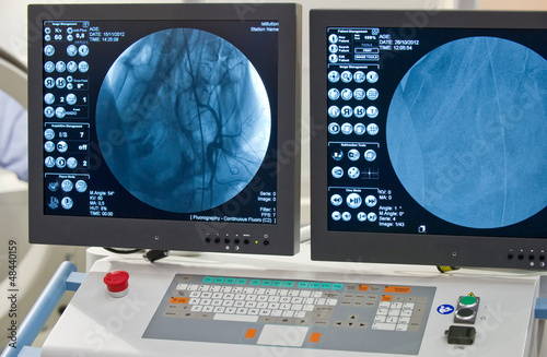 Photo: Angiografie Angiografie
