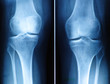 knee x-ray