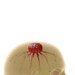 Hirntumor - 3D Render isoliert