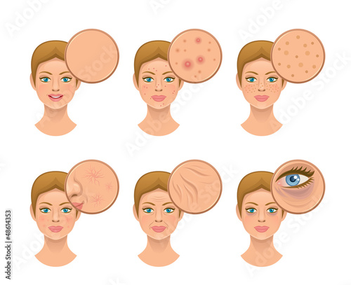 Vector: Problem skin Problem skin
