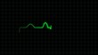 Video: Electrocardiogram animation Electrocardiogram animation