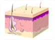 3D skin oblique with cut away epidermis