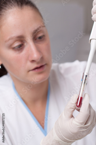 Photo: Micro pipette with blood Micro pipette with blood
