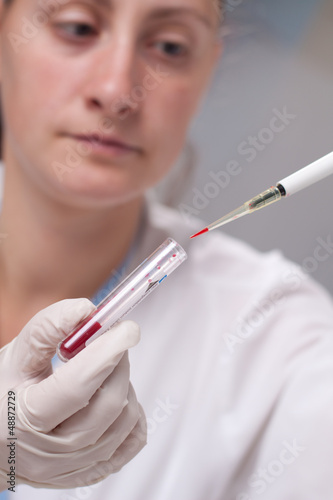 Photo: Micro pipette with blood Micro pipette with blood