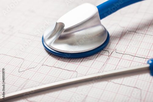Photo: Electrocardiogram Electrocardiogram