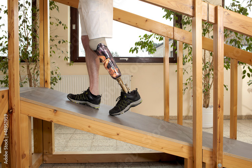 Photo: Male prosthesis wearer training to climb a slope Male prosthesis wearer training to climb a slope
