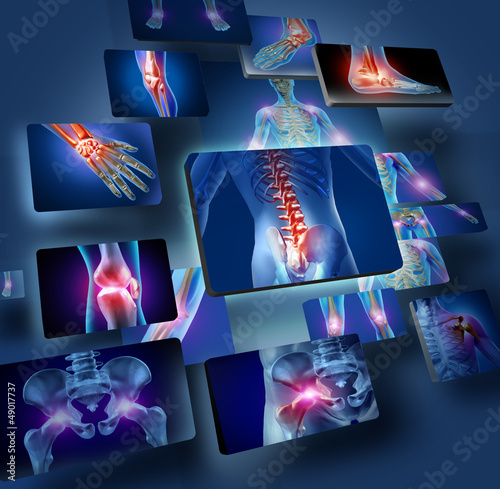 Illustration: Human Joints Concept Human Joints Concept