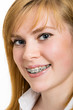 Photo: Beautiful young woman with brackets on teeth Beautiful young woman with brackets on teeth