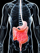 3d rendered illustration of a painful bowel