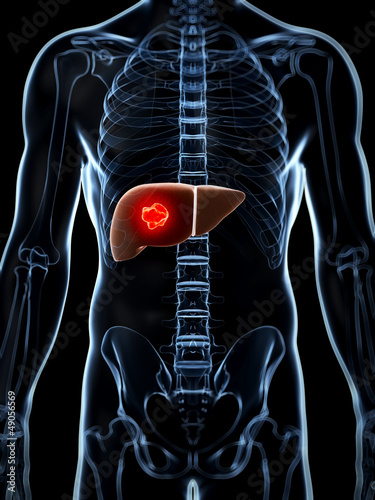 Illustration: 3d rendered illustration of the male liver 3d rendered illustration of the male liver