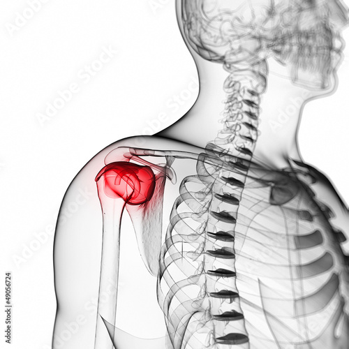 Illustration: 3d rendered illustration of a painful shoulder 3d rendered illustration of a painful shoulder