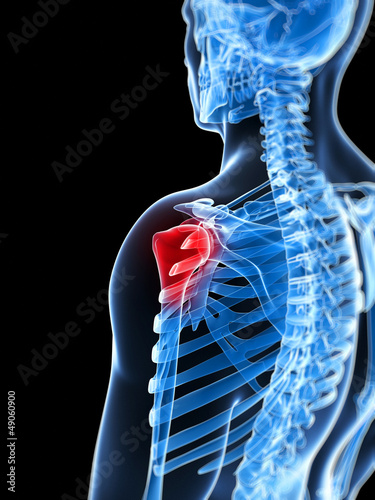 Illustration: 3d rendered illustration of a painful shoulder 3d rendered illustration of a painful shoulder