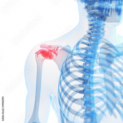 Illustration: 3d rendered illustration of a painful shoulder 3d rendered illustration of a painful shoulder