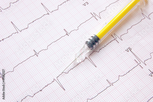 Photo: electrocardiogram with yellow colored syringe electrocardiogram with yellow colored syringe