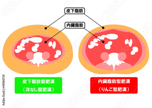 Illustration: 内臓脂肪と皮下脂肪の断面図 内臓脂肪と皮下脂肪の断面図