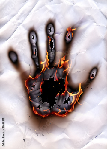 Photo: Burning hand-print Burning hand-print