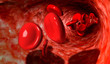 Blood Cells In A Vein