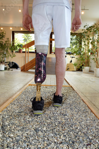 Photo: Male prosthesis wearer training to walk Male prosthesis wearer training to walk