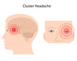 Cluster headache, eps10