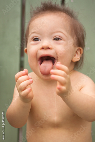 Photo: Down syndrome boy laughing and clapping excitedly Down syndrome boy laughing and clapping excitedly