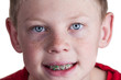 Boy with braces