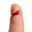 Bleeding from Cut Finger