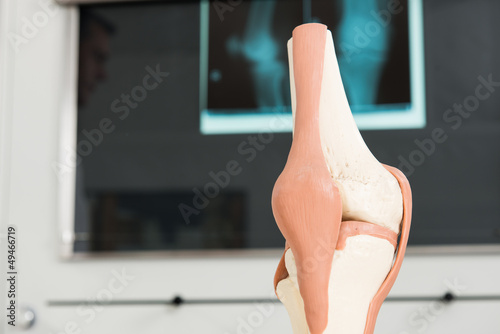 Photo: modell vom kniegelenk modell vom kniegelenk