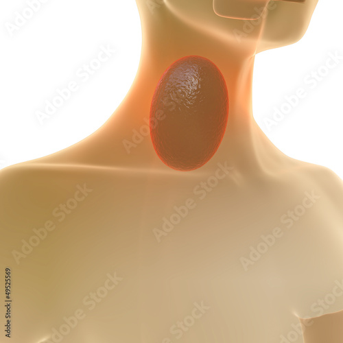 Illustration: Halsschmerzen - 3D Render Halsschmerzen - 3D Render