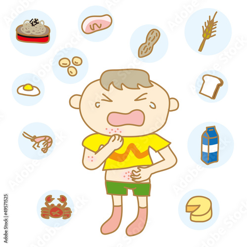 Vector: 食物アレルギーの子ども 食物アレルギーの子ども