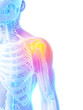 3d rendered illustration - painful shoulder