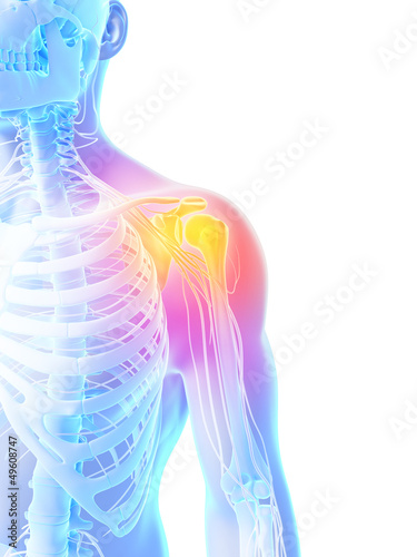 Illustration: 3d rendered illustration - painful shoulder 3d rendered illustration - painful shoulder