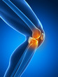 painful knee