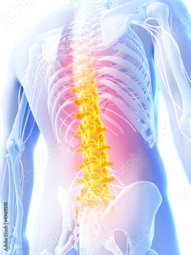 Illustration: 3d rendered illustration - backache 3d rendered illustration - backache