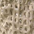 Osteoporose - Macro - 3D render