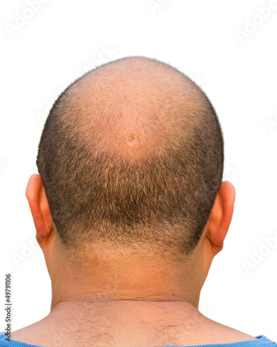 Photo: Bald head isolation Bald head isolation