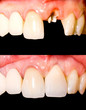 Before and after