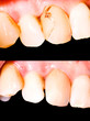 Before and after