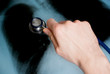 Hand holding a stethoscope on lung Xray photo