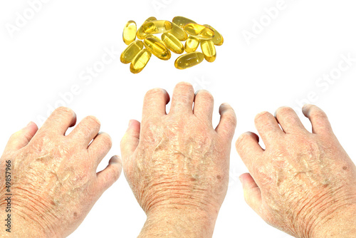 Photo: Hands reaching for vitamin E capsules. Dry shin concept Hands reaching for vitamin E capsules. Dry shin concept