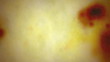 Film Burn Texture